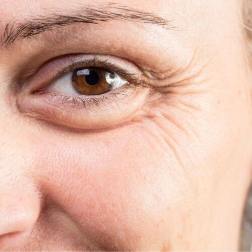 La glycation un facteur de vieillissement cellulaire (1)