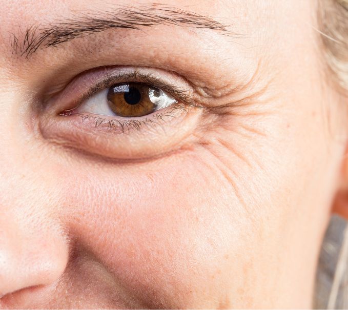 La glycation : un facteur de vieillissement